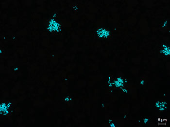 Stained mycoplasma cells